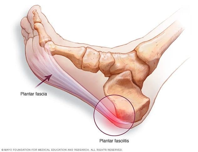 plantar fascia